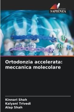 Ortodonzia accelerata: meccanica molecolare - Shah, Kinnari;Trivedi, Kalyani;Shah, Alap