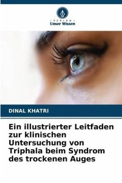 Ein illustrierter Leitfaden zur klinischen Untersuchung von Triphala beim Syndrom des trockenen Auges - KHATRI, DINAL