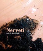 Nervetí Nervetí