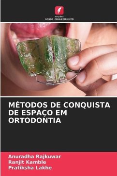 MÉTODOS DE CONQUISTA DE ESPAÇO EM ORTODONTIA - Rajkuwar, Anuradha;Kamble, Ranjit;LAKHE, PRATIKSHA