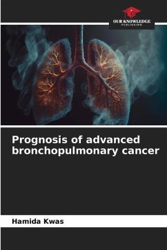 Prognosis of advanced bronchopulmonary cancer - Kwas, Hamida