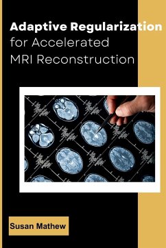 Adaptive Regularization for Accelerated MRI Reconstruction - Mathew, Susan