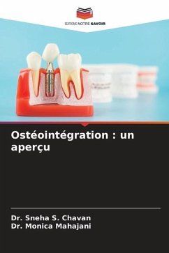 Ostéointégration : un aperçu - Chavan, Dr. Sneha S.;Mahajani, Dr. Monica