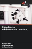 Endodonzia minimamente invasiva