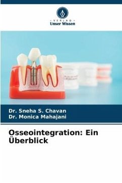 Osseointegration: Ein Überblick - Chavan, Dr. Sneha S.;Mahajani, Dr. Monica