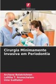 Cirurgia Minimamente Invasiva em Periodontia