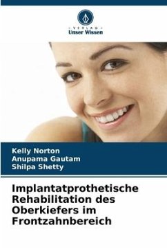 Implantatprothetische Rehabilitation des Oberkiefers im Frontzahnbereich - Norton, Kelly;Gautam, Anupama;Shetty, Shilpa