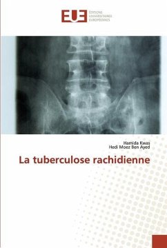 La tuberculose rachidienne - Kwas, Hamida;Ben Ayed, Hedi Moez