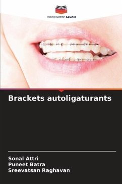 Brackets autoligaturants - Attri, Sonal;Batra, Puneet;Raghavan, Sreevatsan