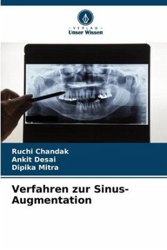 Verfahren zur Sinus-Augmentation - Chandak, Ruchi;Desai, Ankit;Mitra, Dipika