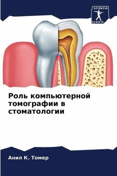Rol' komp'üternoj tomografii w stomatologii - Tomer, Anil K.