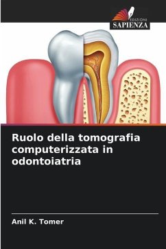 Ruolo della tomografia computerizzata in odontoiatria - Tomer, Anil K.