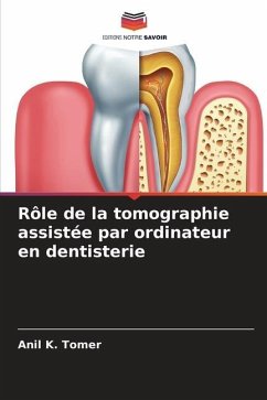 Rôle de la tomographie assistée par ordinateur en dentisterie - Tomer, Anil K.