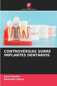 CONTROVÉRSIAS SOBRE IMPLANTES DENTÁRIOS - Chacko, Lisa;Dalve, Deveshri