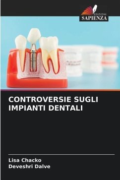 CONTROVERSIE SUGLI IMPIANTI DENTALI - Chacko, Lisa;Dalve, Deveshri