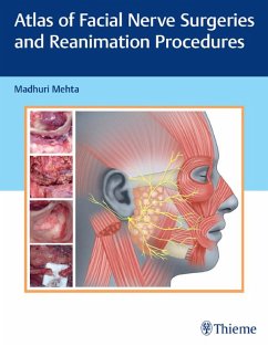 Atlas of Facial Nerve Surgeries and Reanimation Procedures (eBook, ePUB)