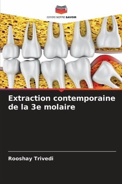 Extraction contemporaine de la 3e molaire - Trivedi, Rooshay