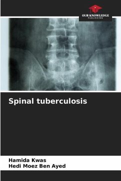 Spinal tuberculosis - Kwas, Hamida;Ben Ayed, Hedi Moez