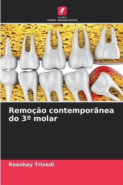 Remoção contemporânea do 3º molar - Trivedi, Rooshay