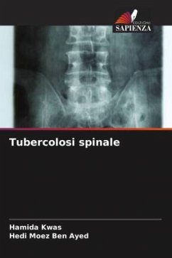 Cover Tubercolosi spinale