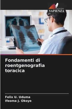 Fondamenti di roentgenografia toracica - Uduma, Felix U.;Okoye, Ifeoma J.
