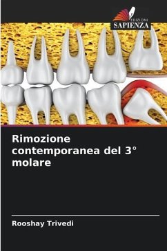 Rimozione contemporanea del 3° molare - Trivedi, Rooshay