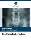 Die Spinaltuberkulose