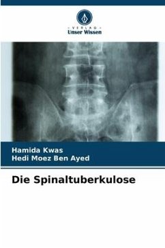 Die Spinaltuberkulose - Kwas, Hamida;Ben Ayed, Hedi Moez