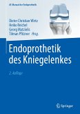 Endoprothetik des Kniegelenkes (eBook, PDF)