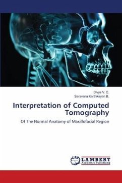 Interpretation of Computed Tomography - V. C., Divya;B., Saravana Karthikeyan