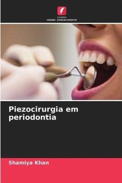 Piezocirurgia em periodontia - KHAN, SHAMIYA