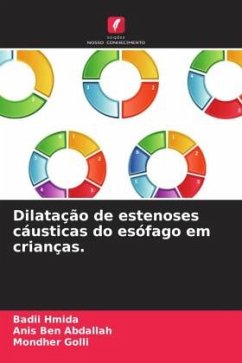 Cover Dilatação de estenoses cáusticas do esófago em crianças.