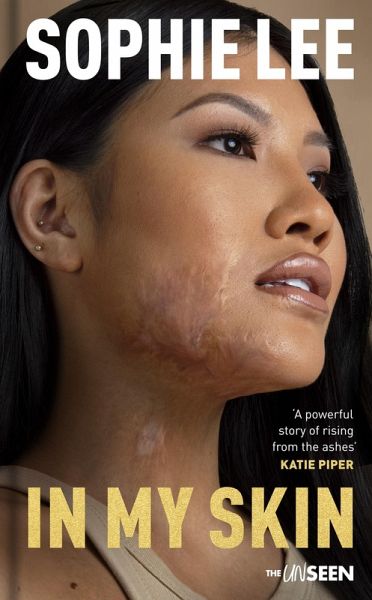 In My Skin (eBook, ePUB) In My Skin (eBook, ePUB)