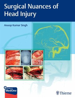 Surgical Nuances of Head Injury - Singh, Anoop Kumar