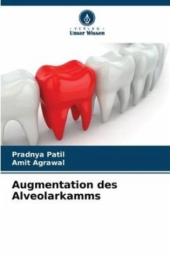 Augmentation des Alveolarkamms - Patil, Pradnya;Agrawal, Amit