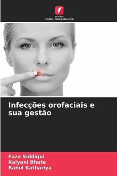 Infecções orofaciais e sua gestão - Siddiqui, Faza;Bhate, Kalyani;Kathariya, Rahul