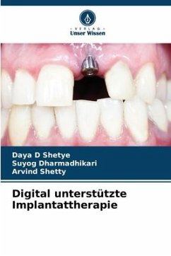 Digital unterstützte Implantattherapie - Shetye, Daya D;Dharmadhikari, Suyog;Shetty, Arvind