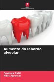 Aumento do rebordo alveolar