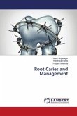 Root Caries and Management
