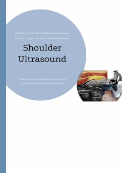 Shoulder Ultrasound (eBook, ePUB)