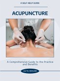 Acupuncture (eBook, ePUB)