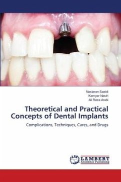 Theoretical and Practical Concepts of Dental Implants