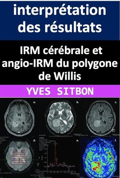 Cover IRM cérébrale et angio-IRM du polygone de Willis : interprétation des résultats et implications cliniques. (eBook, ePUB)