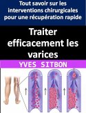 Traiter efficacement les varices : Tout savoir sur les interventions chirurgicales pour une récupération rapide (eBook, ePUB)