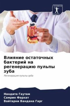 Cover Vliqnie ostatochnyh bakterij na regeneraciü pul'py zuba