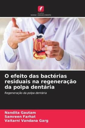 O efeito das bactérias residuais na regeneração da polpa dentária O efeito das bactérias residuais na regeneração da polpa dentária