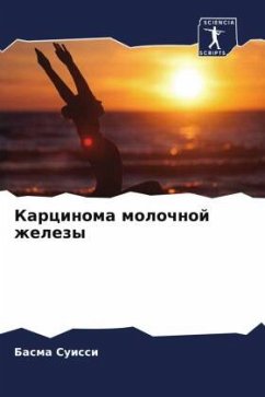 Cover Karcinoma molochnoj zhelezy