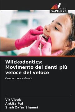 Wilckodontics: Movimento dei denti più veloce del veloce - Vivek, Vir;Pal, Ankita;Shamsi, Shah Zafar