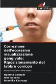 Correzione dell'eccessiva visualizzazione gengivale: Riposizionamento del labbro con/con