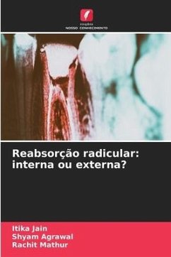 Reabsorção radicular: interna ou externa? - Jain, Itika;Agrawal, Shyam;Mathur, Rachit